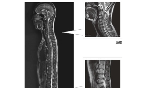 3.0T MRI | 森の木脳神経脊髄外科